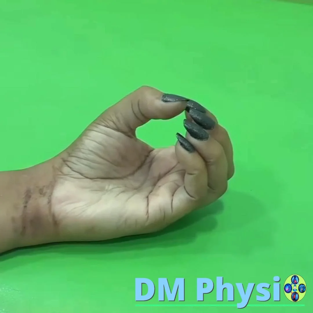 Късен етап на синдрома